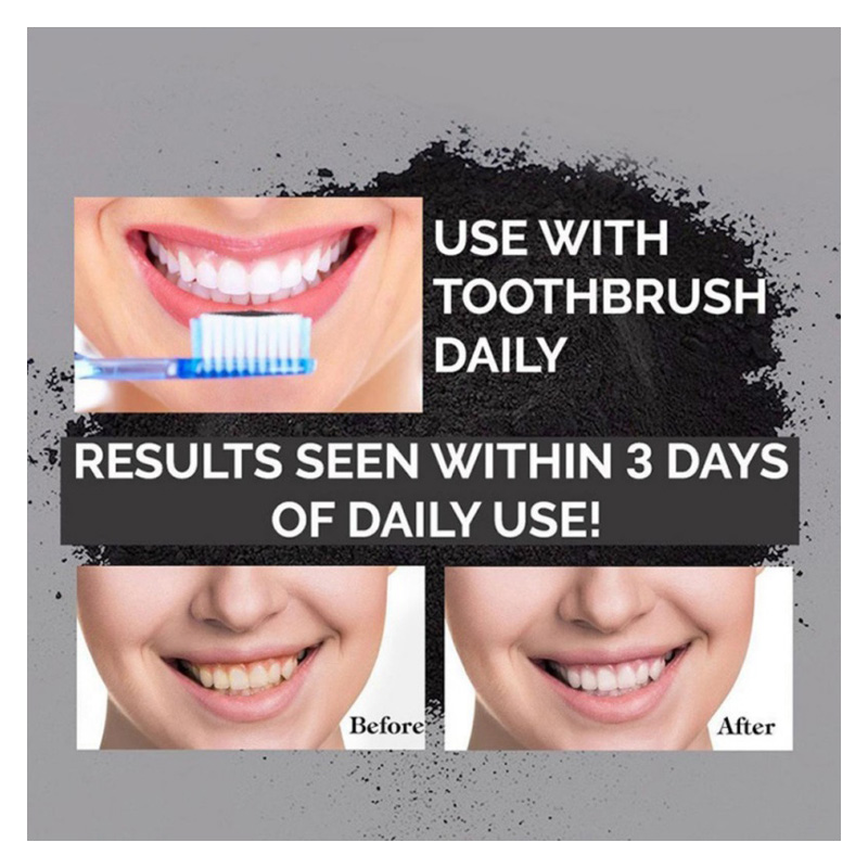 MISS ROSE 0312B BLANCHIMENT DES DENTS